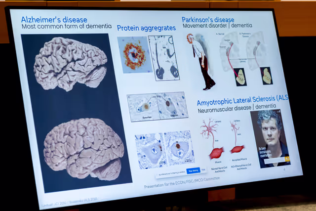Fotogrāfija 28: SANT- Public hearing ' Brain health: Policy challenges and opportunities to manage neurological diseases '